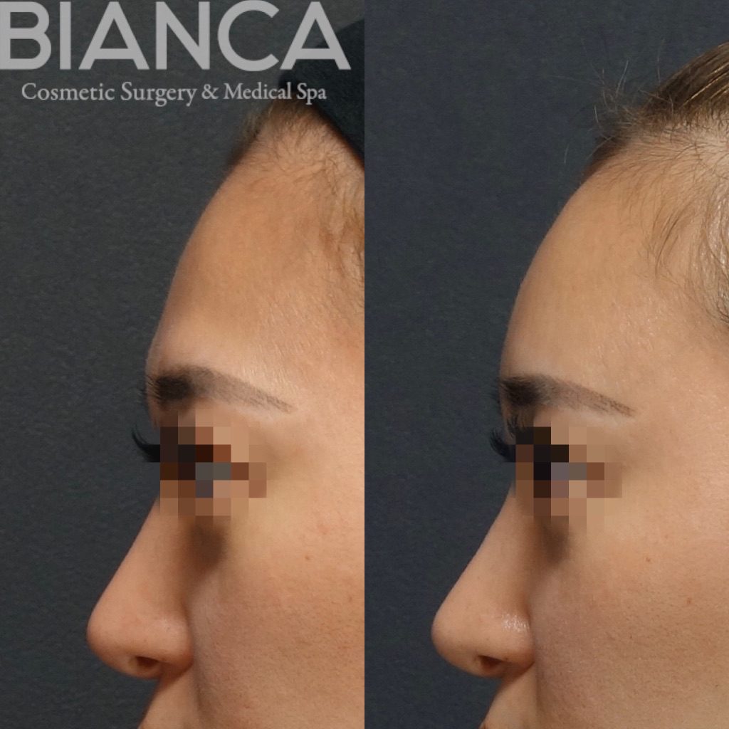 コンデンスリッチフェイス