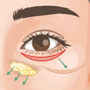 ハムラ法 ビアンカ銀座｜日本を代表する美容健康再生医療のクリニック