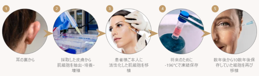 真皮線維芽細胞療法（Fibroblasts）とは