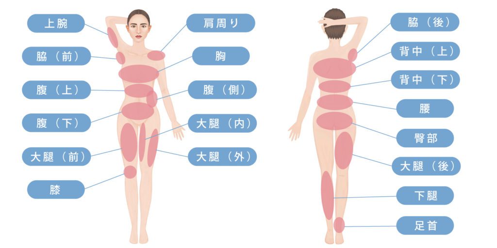 脂肪吸引とCRFのお勉強