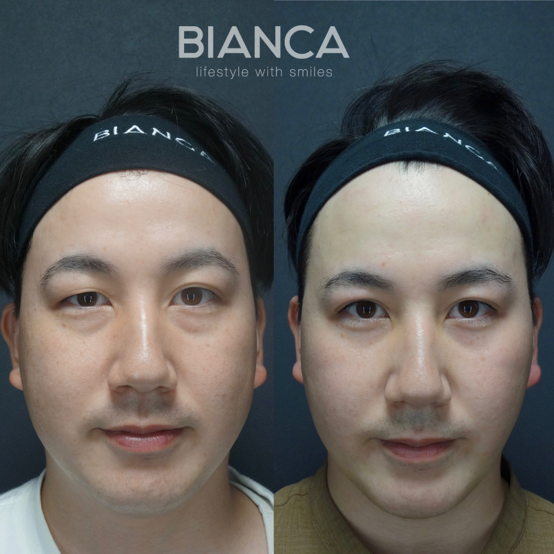 男性のトータル美容医療
