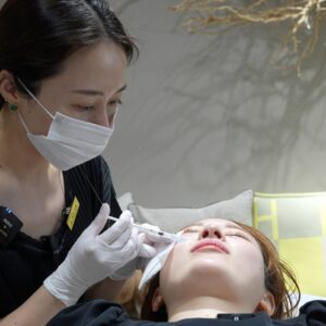 明石仙姫医師のボトックス施術