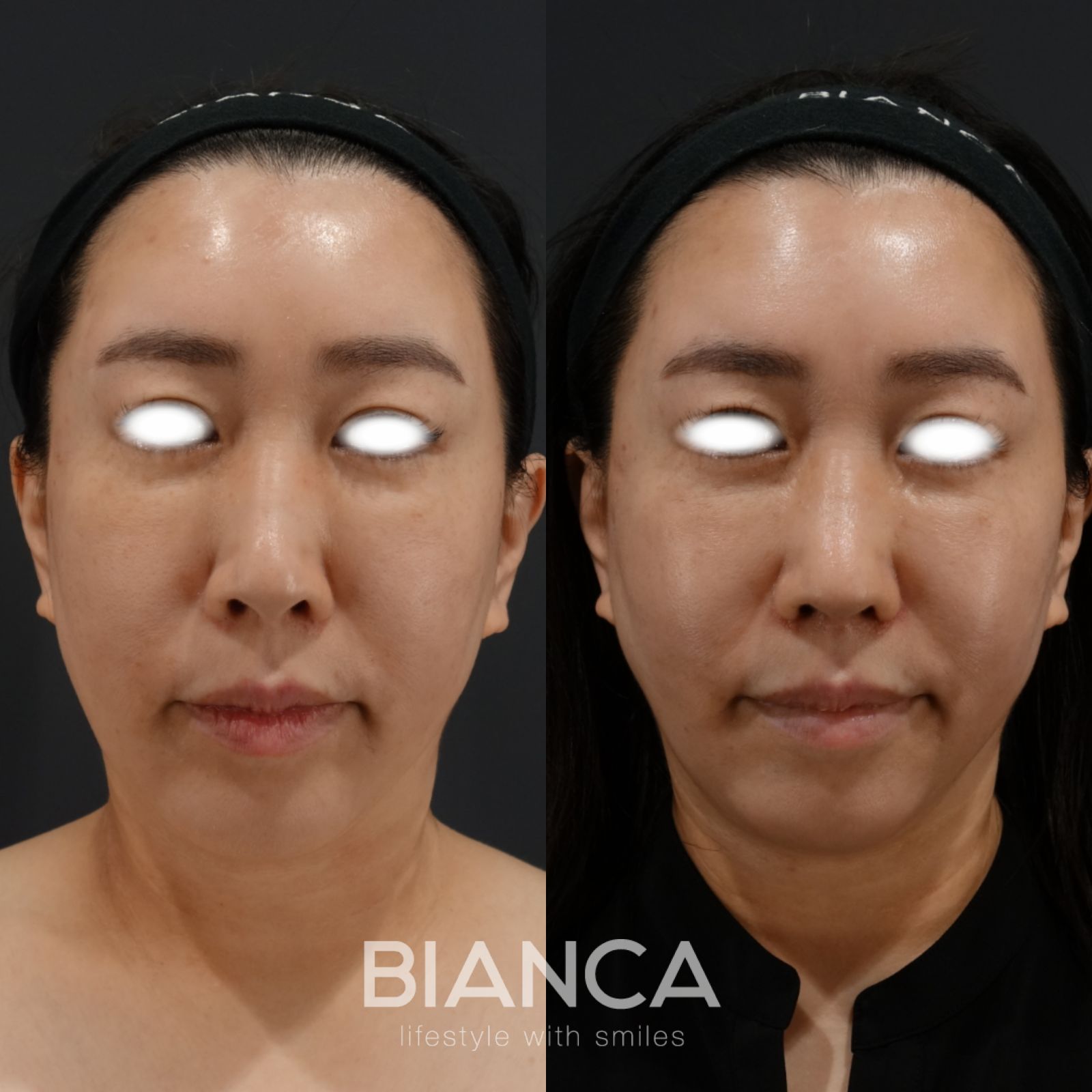 日本の先端、世界の先端技術を アジアンノーズに
