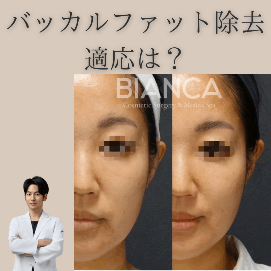 非公開: バッカルファット除去の適応は？