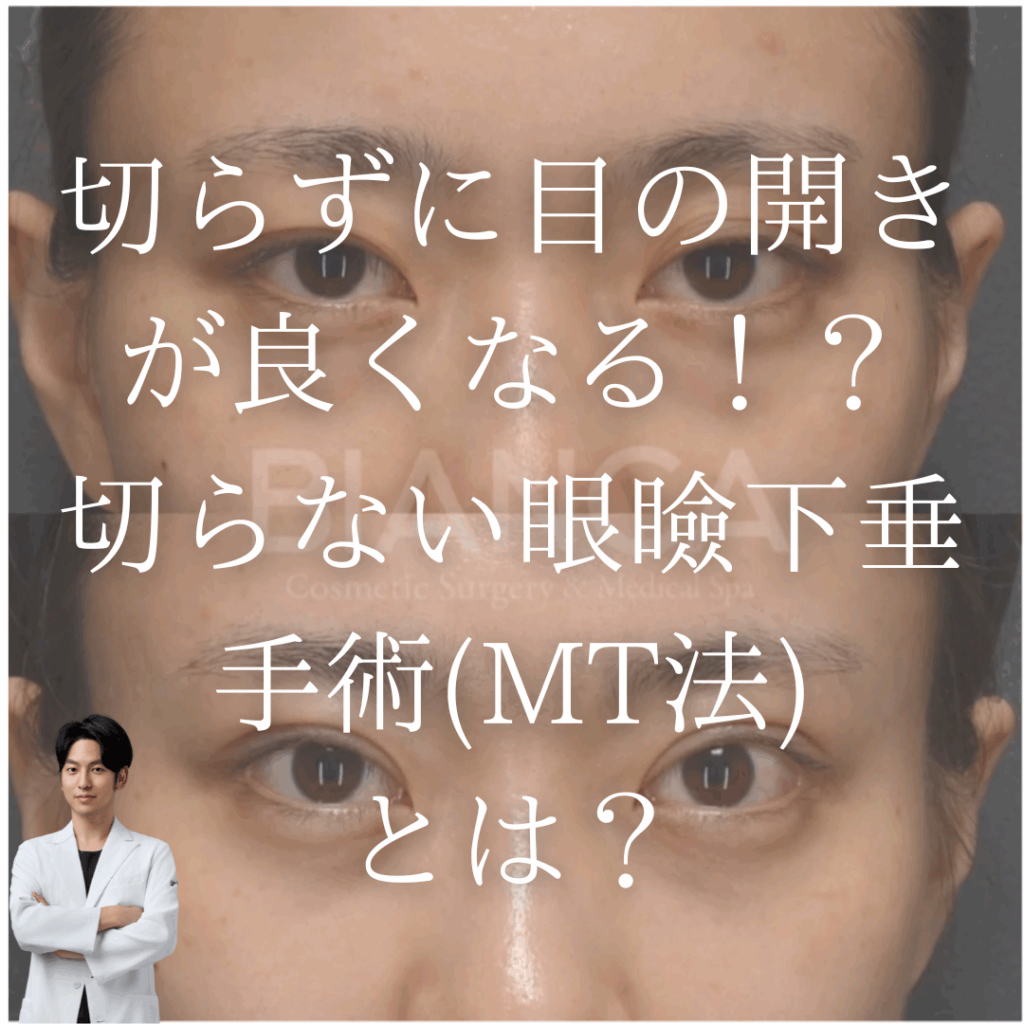 非公開: 目の開きをよくする、”切らない眼瞼下垂手術(MT法)”とは？