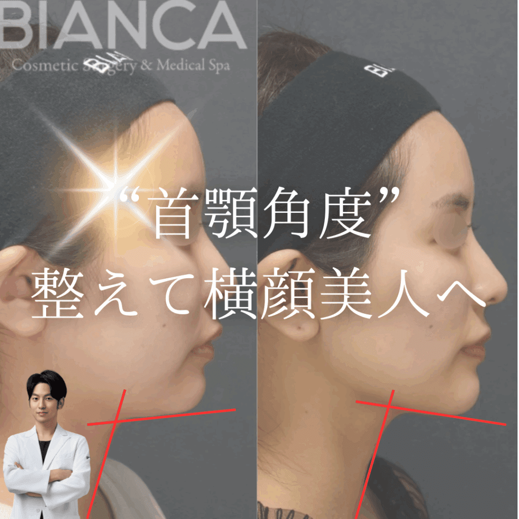 非公開: E-Lineだけじゃない！横顔美人の条件”首顎角度”とは？