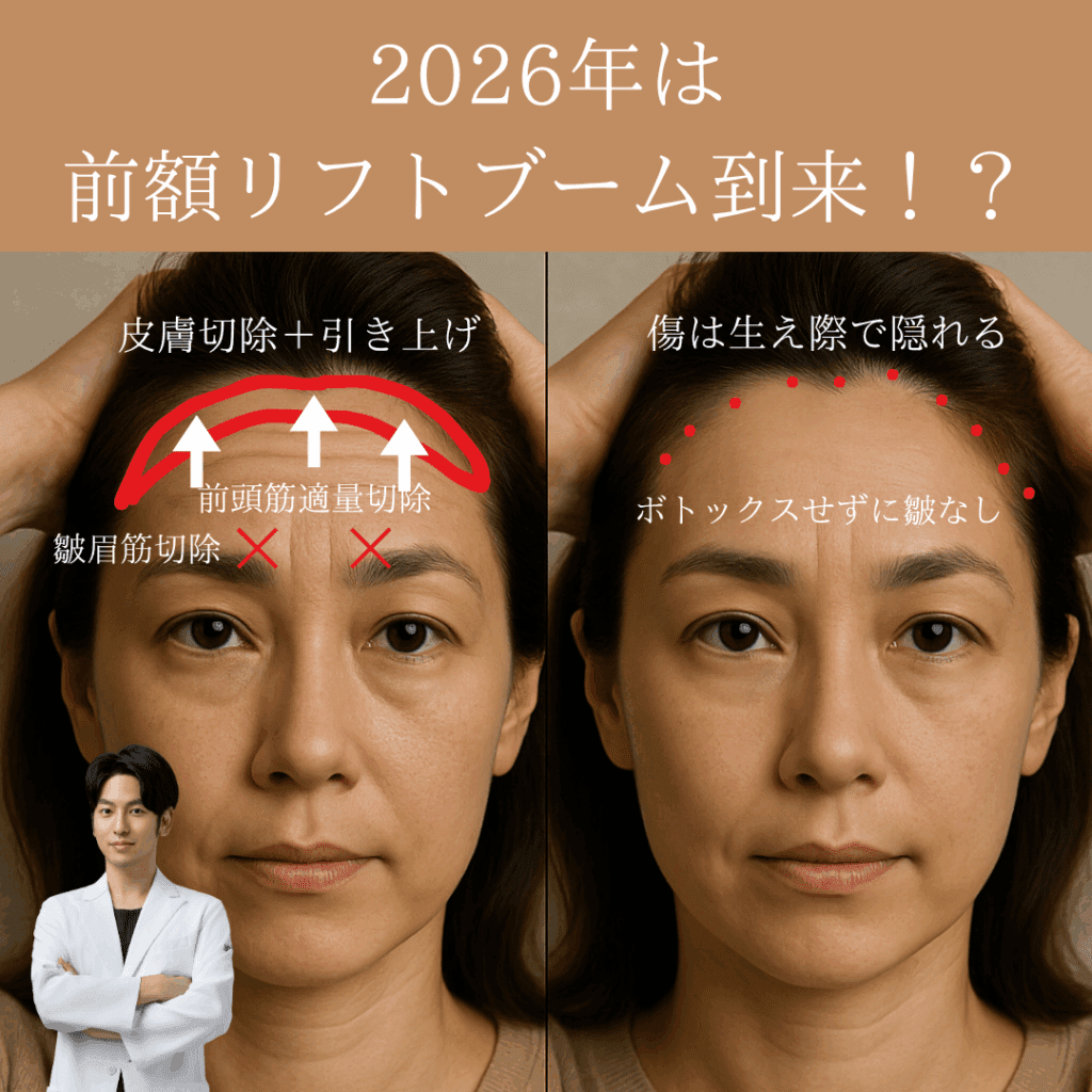 非公開: 2026年は前額リフトブームが到来！？