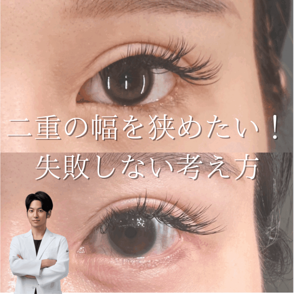 非公開: 二重の幅を狭めたい！失敗しないために二重整形の考え方を学ぼう