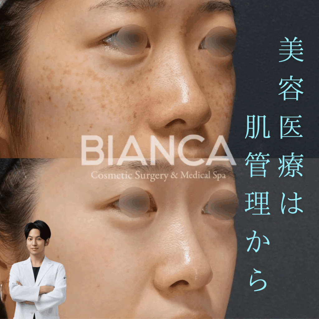 非公開: ピコトーニング、ピコスポット、ピコフラクショナル違いは？