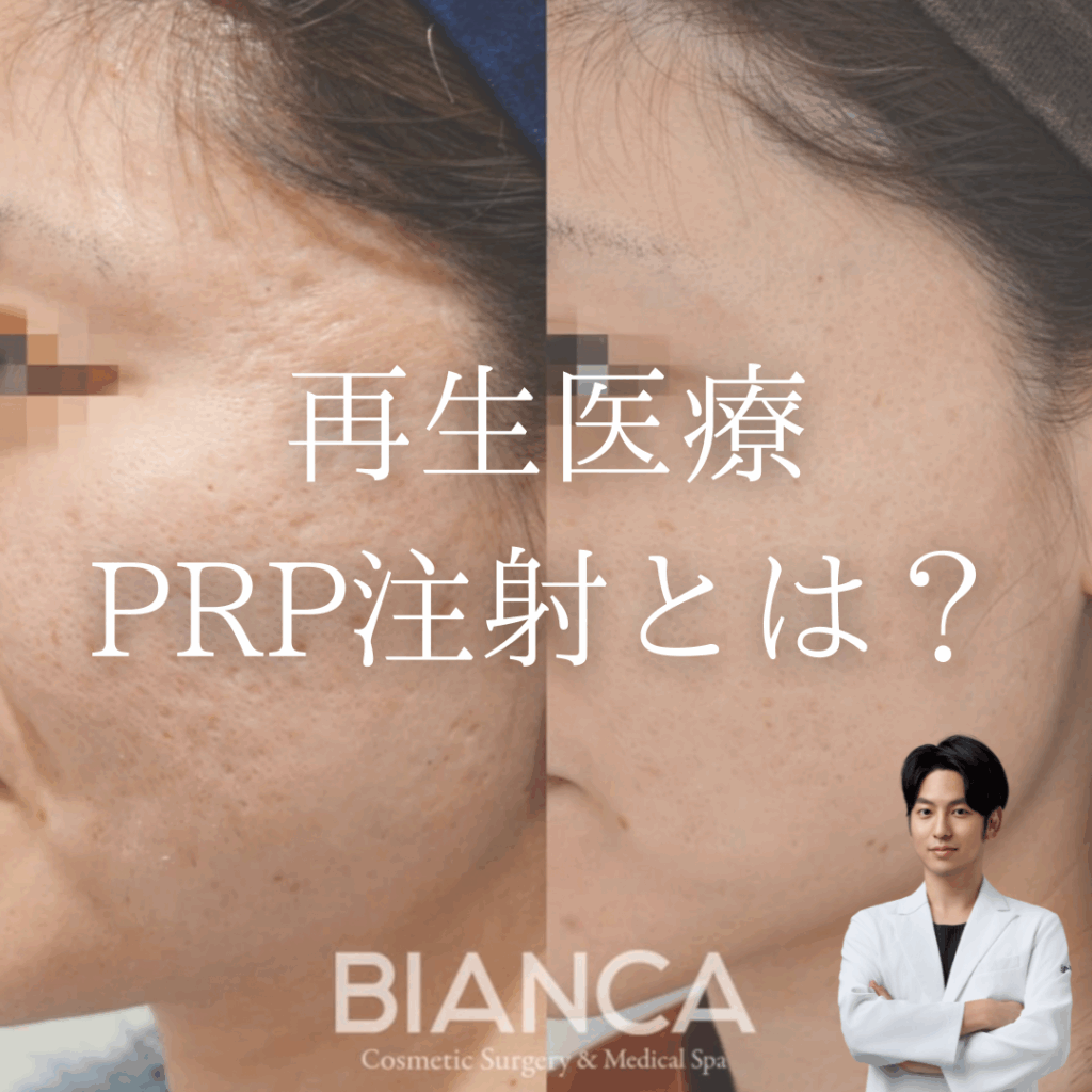 非公開: PRP注入（自己多血小板血漿注入療法）とは？
