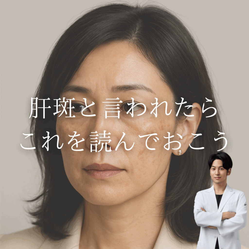 非公開: 肝斑と言われたらこれを読んでおこう