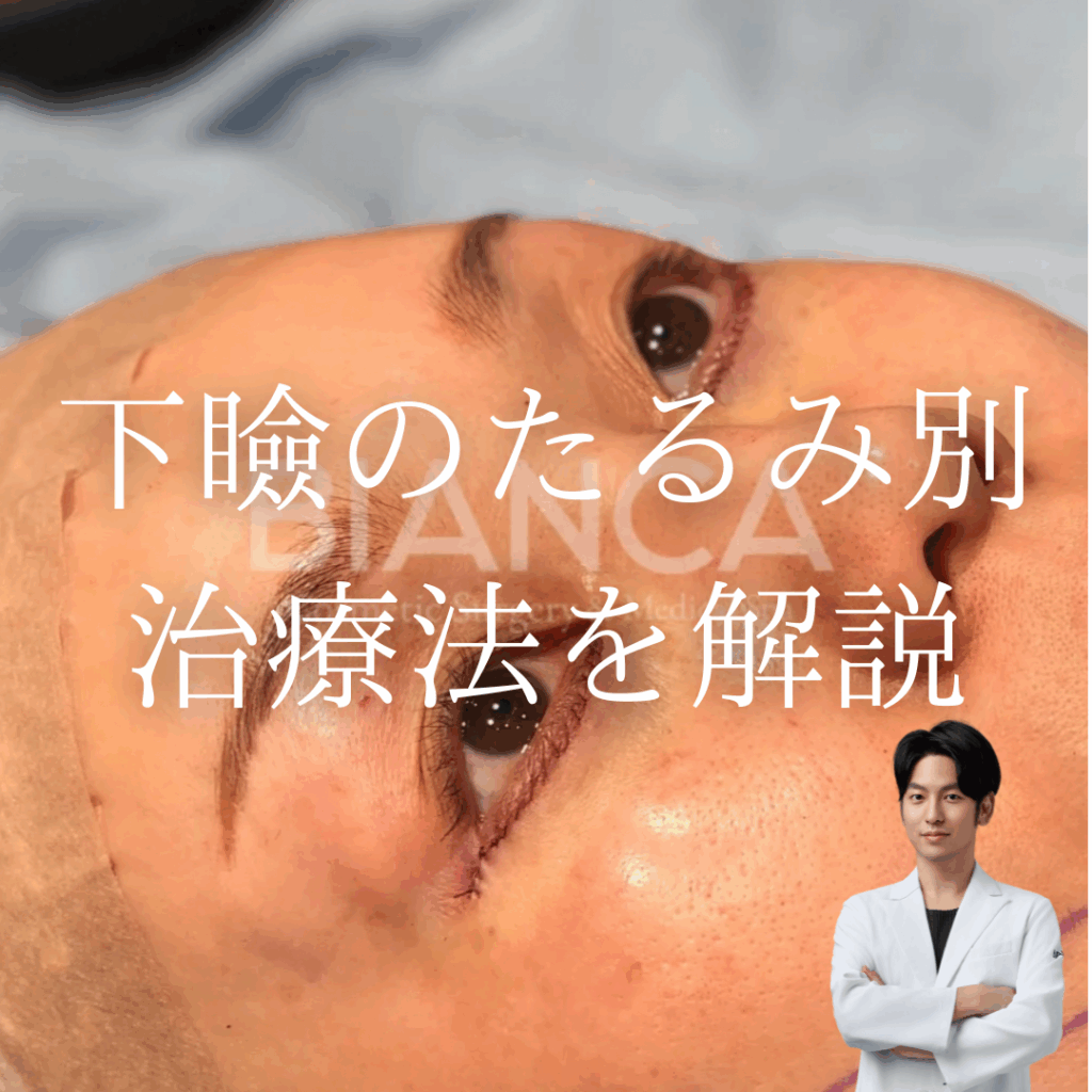 非公開: 下瞼のたるみ別治療法を解説