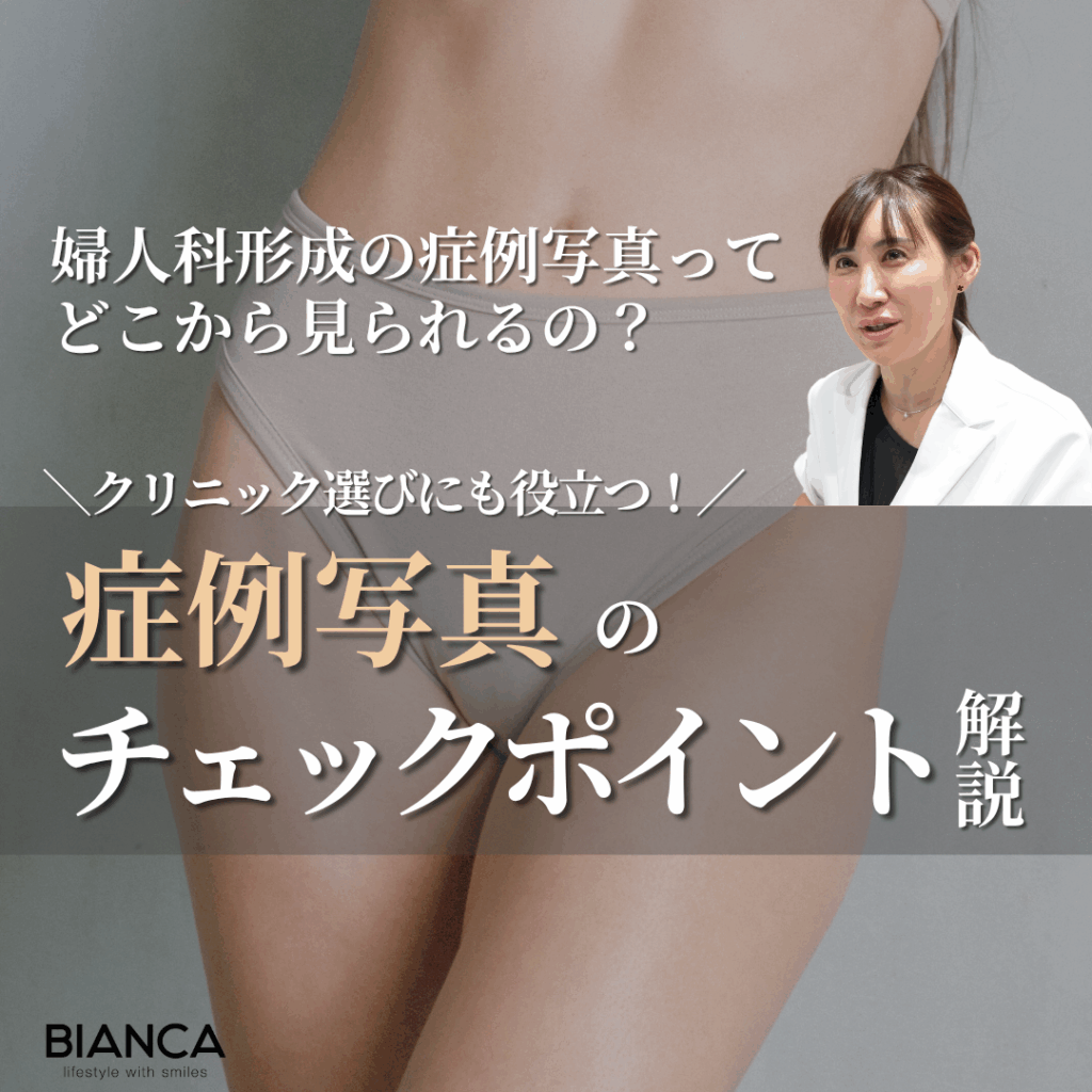 【婦人科形成の症例写真】どこで見られる？クリニック選びにも役立つチェックポイントとは？ビアンカの美容婦人科指導医 宮本亜希子が解説！