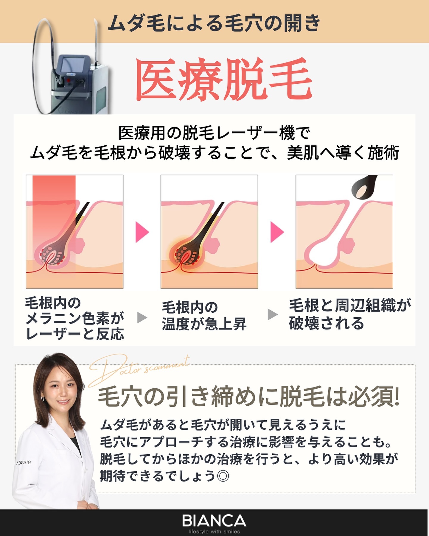 脱毛とは