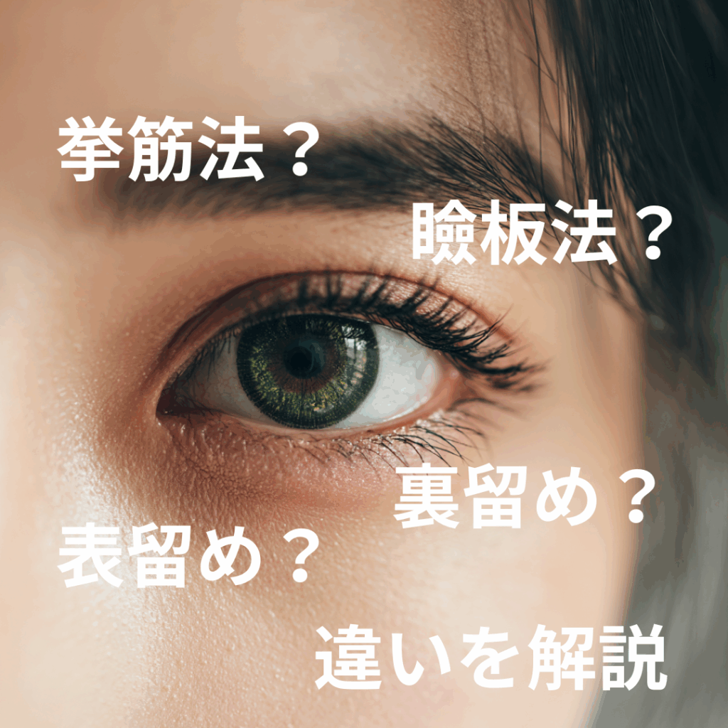 埋没は結局何法がいいの？固定法・表留め/裏留めを比較