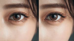 目は全方向に広げられる？目元の拡大術を徹底解説｜ビアンカ銀座｜日本を代表する美容健康再生医療のクリニック