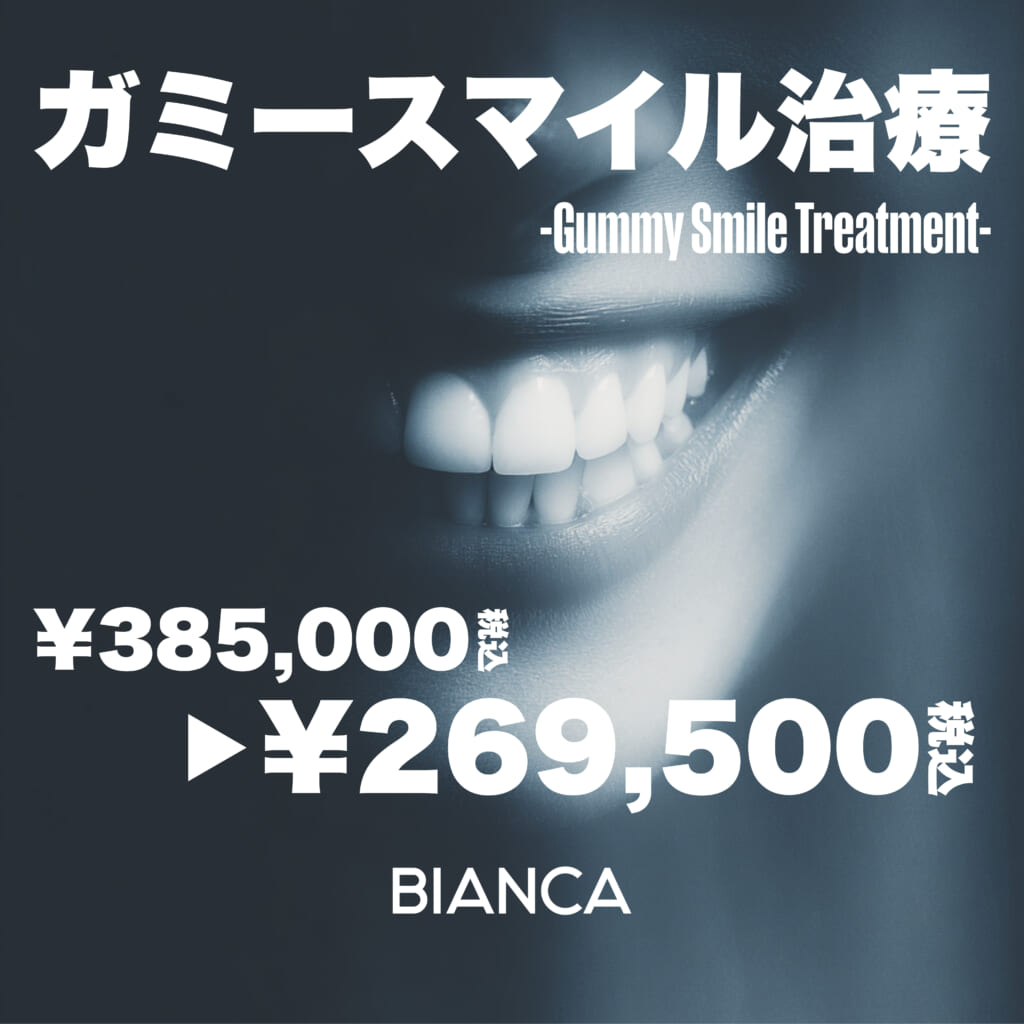 【銀座限定】ガミースマイル治療のスペシャリストが担当します