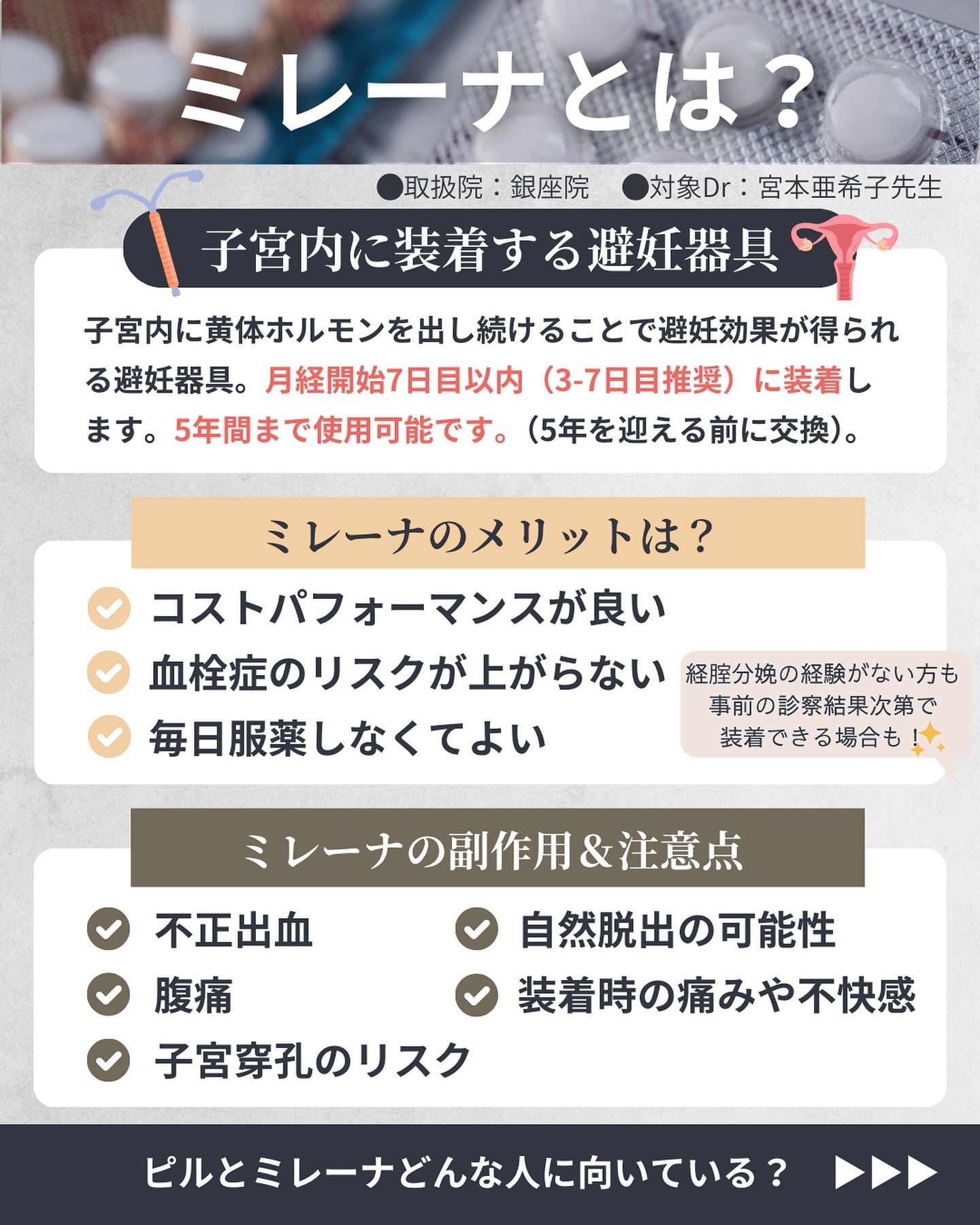 ミレーナとは