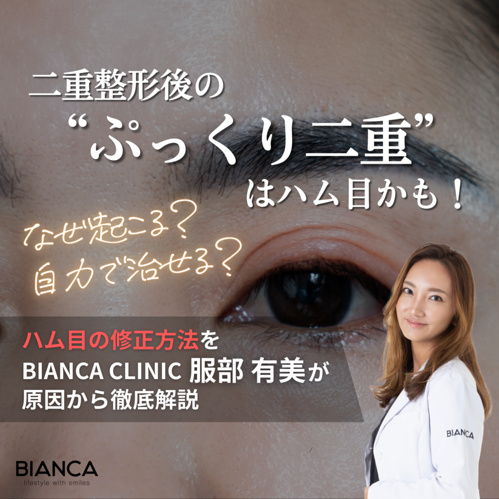 ハム目の修正方法は？なぜ起こる？医師が原因別にわかりやすく解説