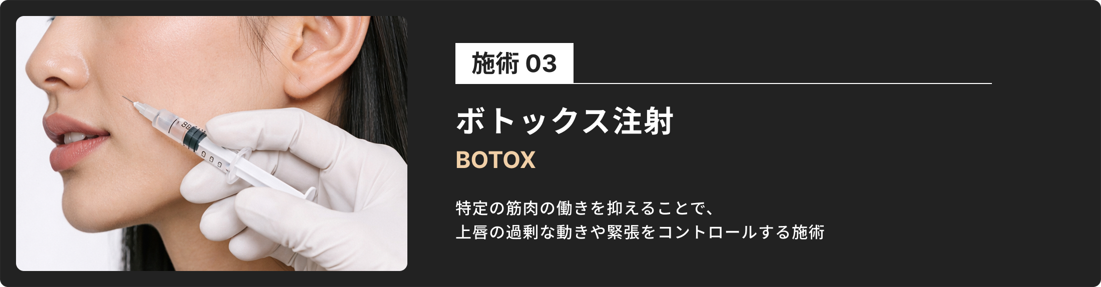 ガミースマイル治療