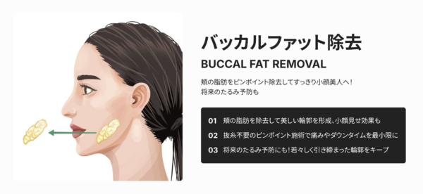 バッカルファットとは？｜頬の脂肪吸引との違い｜ビアンカ銀座｜日本を代表する美容健康再生医療のクリニック